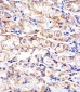 CDH1 Antibody